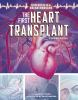The_first_heart_transplant