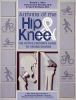 Arthritis_of_the_hip_and_knee