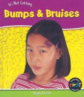 Bumps___bruises
