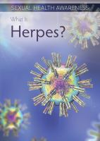 What_is_herpes_