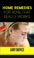 Home_Remedies_for_Acne_That_Really_Works