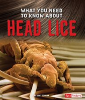 What_You_Need_to_Know_about_Head_Lice