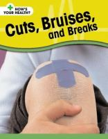 Cuts__bruises__and_breaks